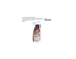 Shimano Pinza Freno XT BR-M8000 9 Shimano Pinza Freno XT BR-M8000 -Bicicleta Ventas pinza shimano xt br m8000 3